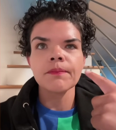 보톡스-주사시술이-불러일으킬-수-있는-부작용-2-이미지