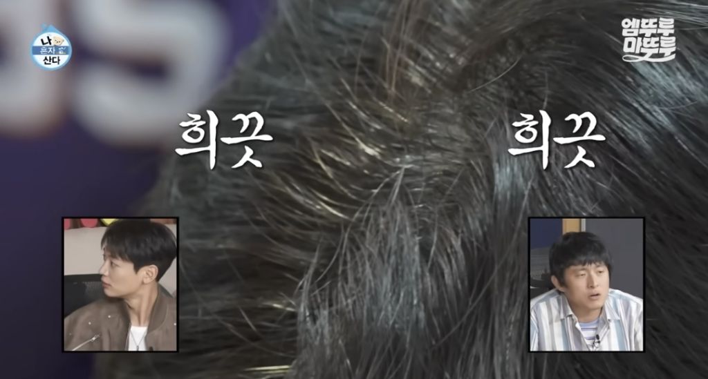 생각보다-젊은-사람들도-많다는-흰머리-2-이미지