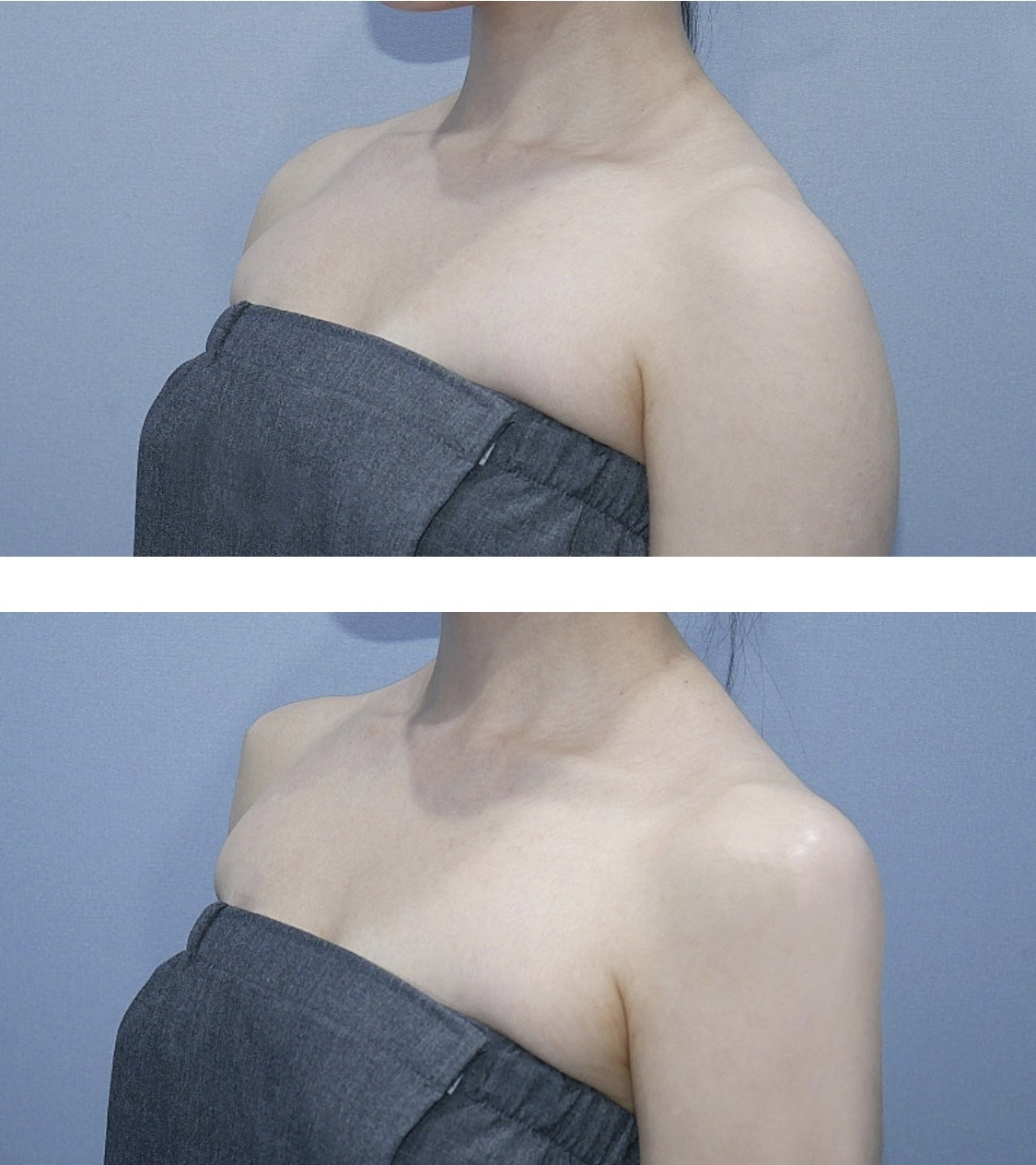 최근들어-직각어깨가-급-많아진-이유ㄷㄷㄷ-(f.조두팔)-5-이미지