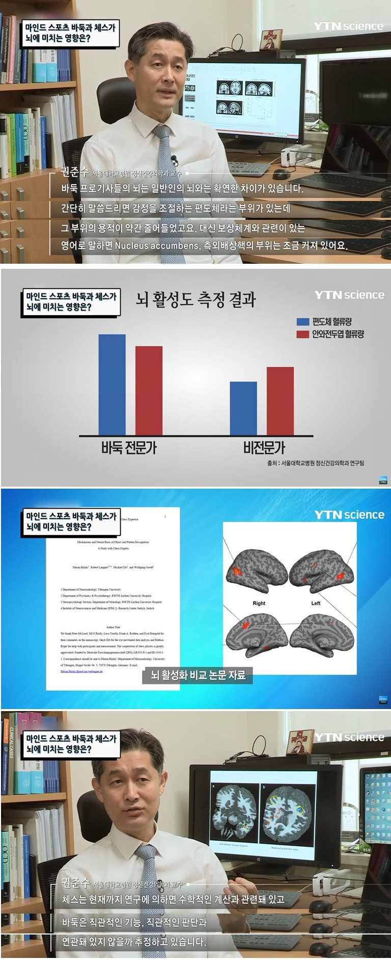 바둑과-체스가-뇌에-미치는-영향.gif-0-이미지