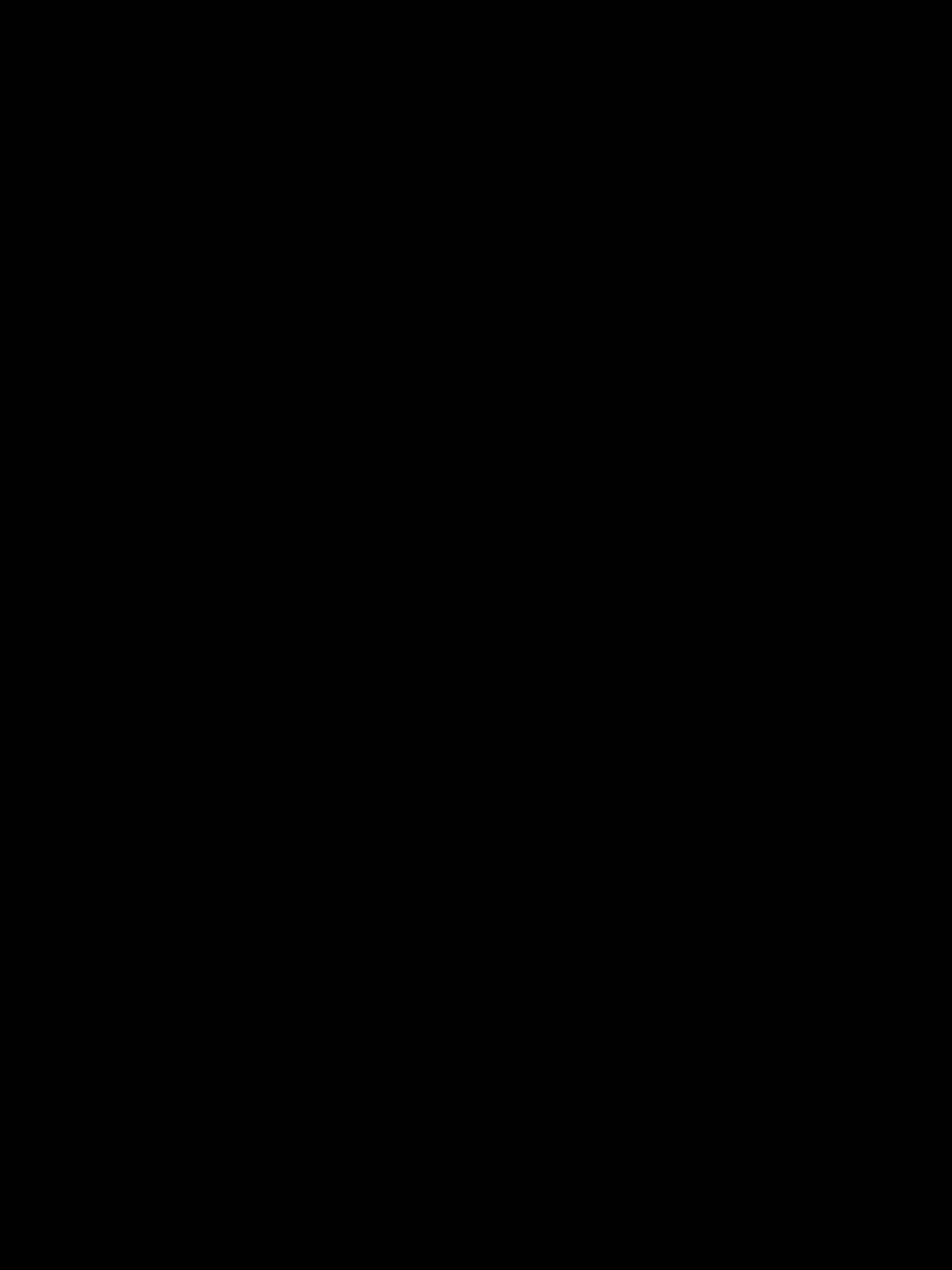 형아!-나-드디어-눈-기증-받게-됐대!-4-이미지