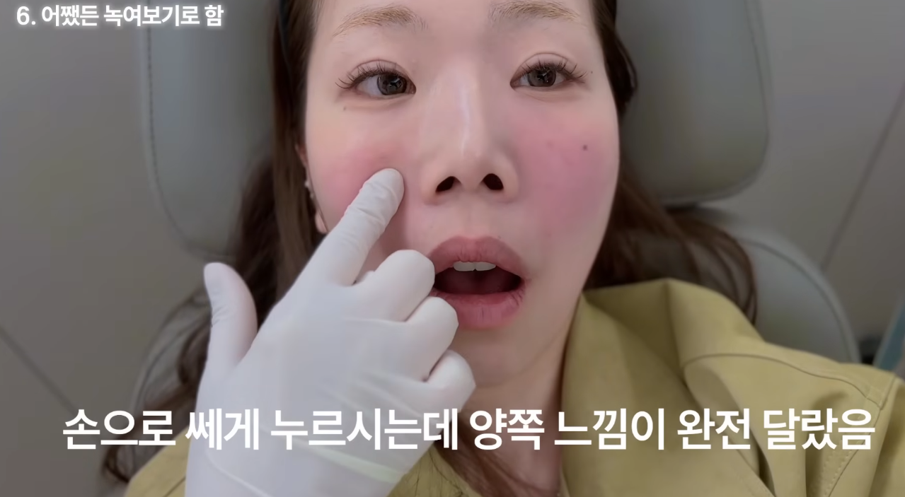 의외로-흔하다는-넣은-적-없는데-필러가-들어있는-경우-34-이미지