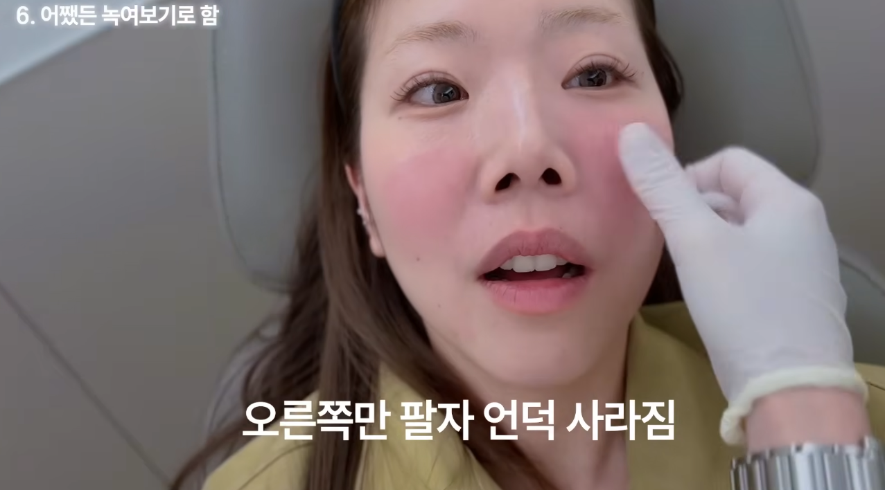 의외로-흔하다는-넣은-적-없는데-필러가-들어있는-경우-32-이미지