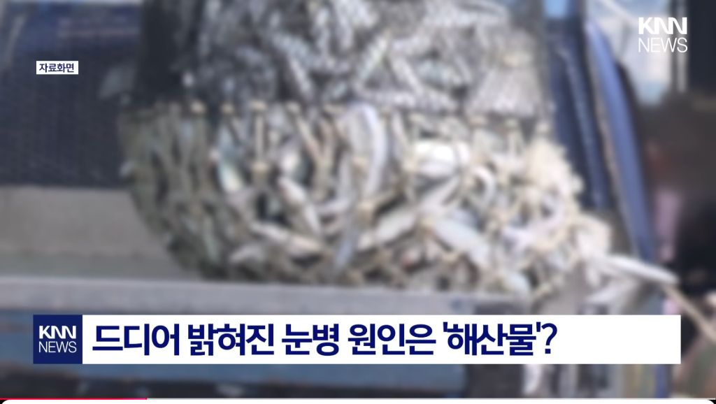 최근-확산중인-"중국발-미스테리-눈병"-1-이미지