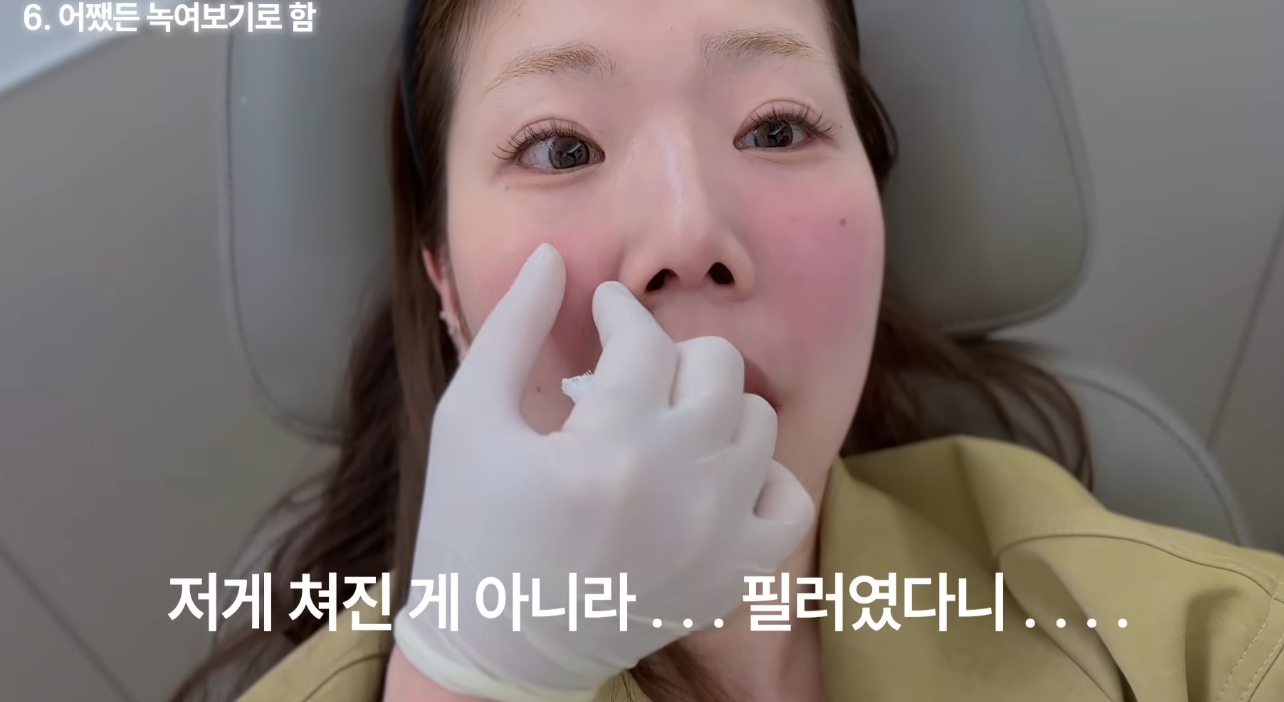 의외로-흔하다는-넣은-적-없는데-필러가-들어있는-경우-33-이미지