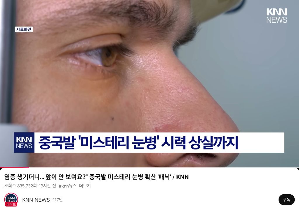 최근-확산중인-"중국발-미스테리-눈병"-0-이미지