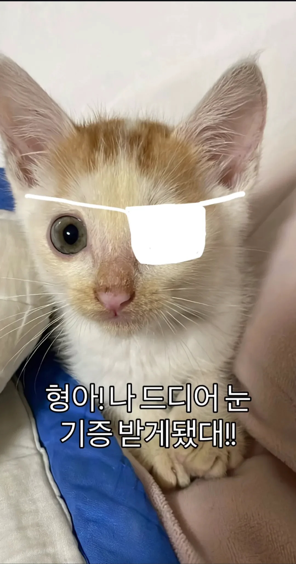 형아!-나-드디어-눈-기증-받게-됐대!-0-이미지