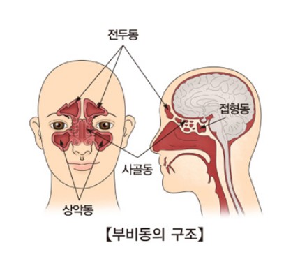 눈알이-빠질것-같고-편두통이-오지며-갑자기-치통이-생긴다면-바로-'이-병'이다.-0-이미지