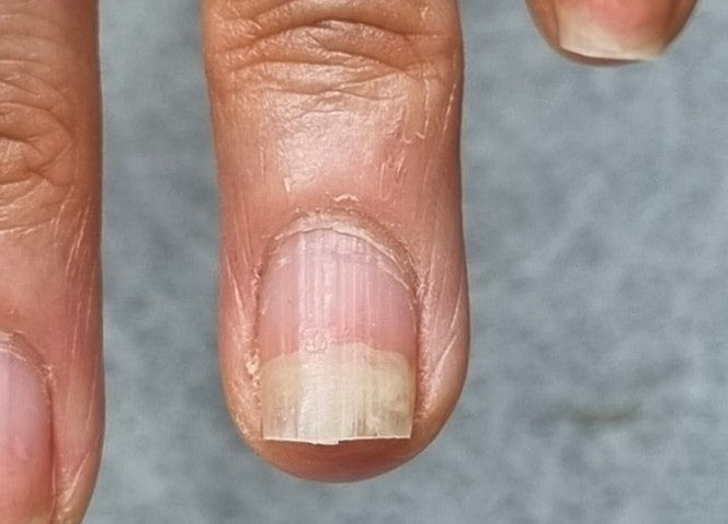 사람-볼-때-정떨어지는-부분갑-2-이미지