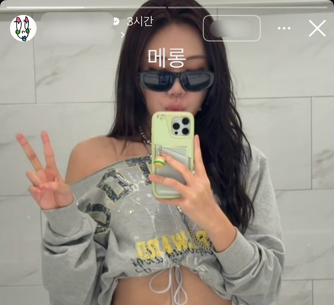 이영지,-갑자기-고백한-성형시술-"4년-고민-끝에-눈밑-지방-재배치"-0-이미지