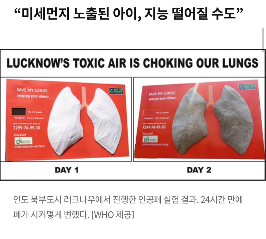 "미세먼지-노출된-인공-폐-하루-만에-새까매졌다"-0-이미지