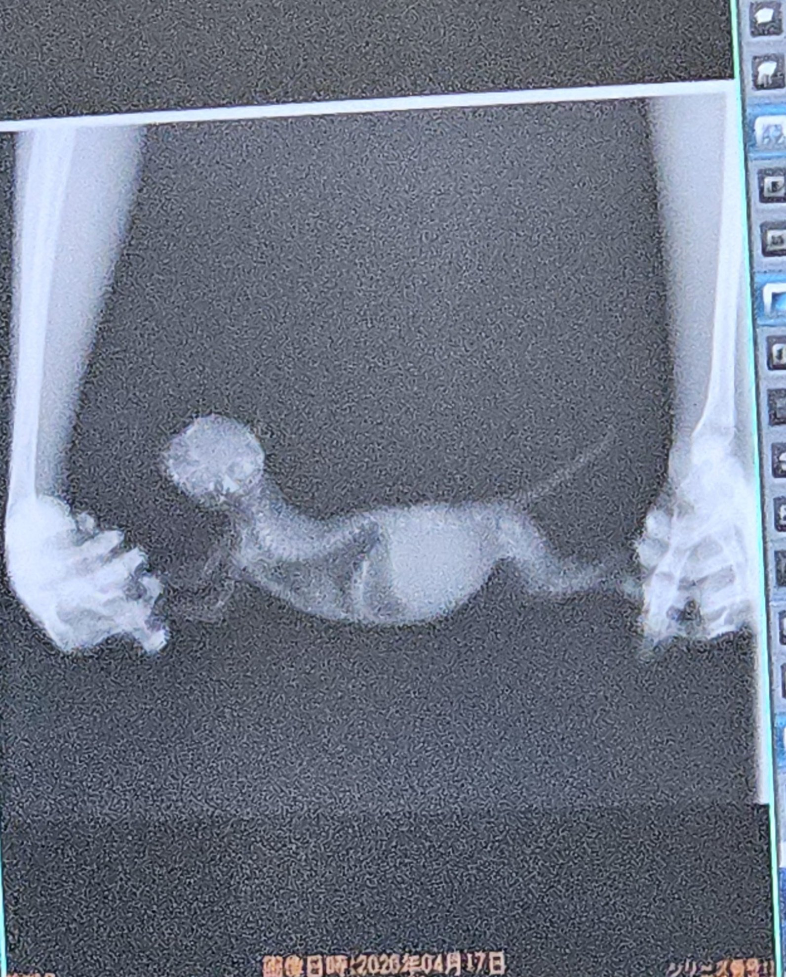 배가-너무-볼록해서-엑스레이-찍은-고양이-1-이미지