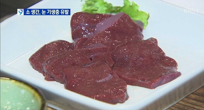 기생충-전문가들이-다른건-다-먹어도-되는데-이것만큼은-절대-먹지-말라고-하는것-0-이미지