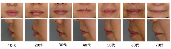 나이가-들면-입술이-없어짐-1-이미지