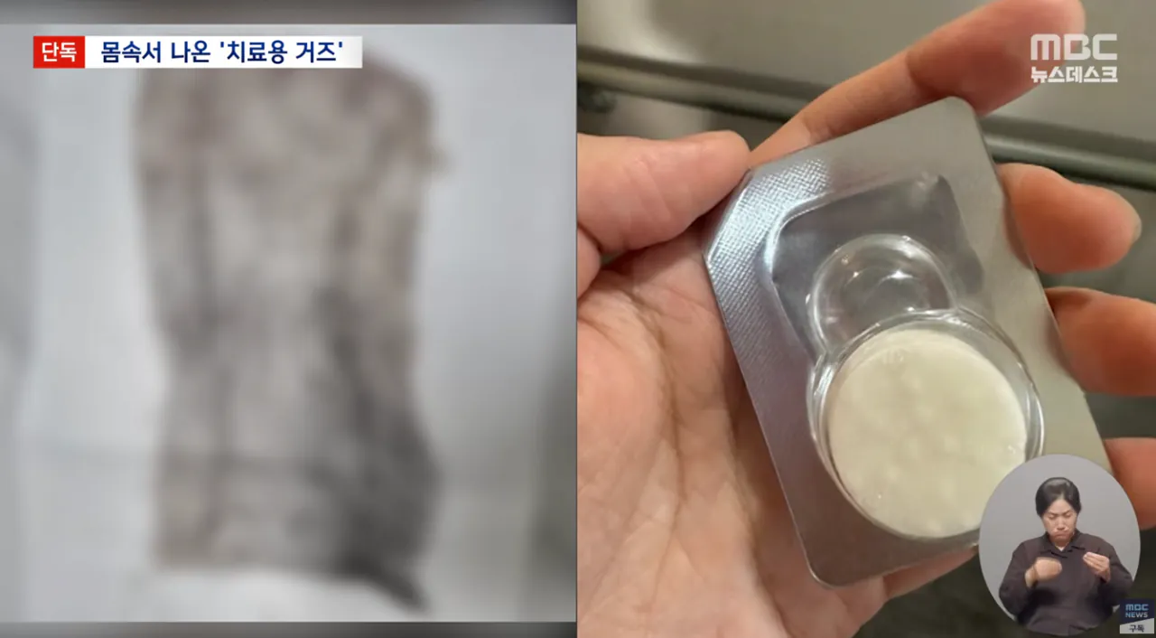 생리하다가-나온-손바닥만한-'치료용-거즈'-7-이미지