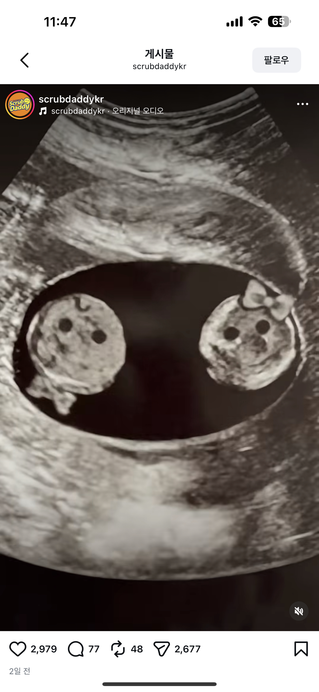 스크럽대디-공식-계정에-올라온-임테기-2-이미지