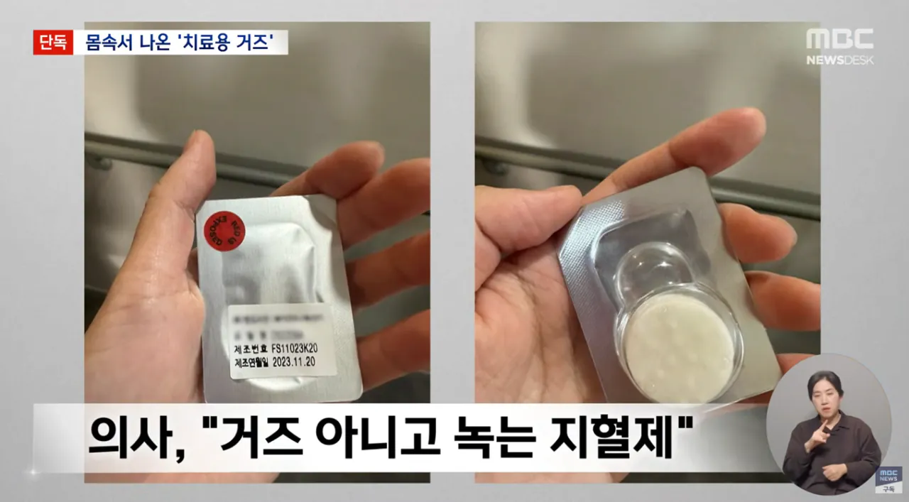 생리하다가-나온-손바닥만한-'치료용-거즈'-5-이미지