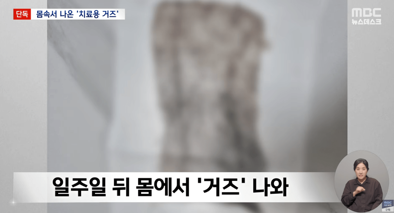 생리하다가-나온-손바닥만한-'치료용-거즈'-3-이미지