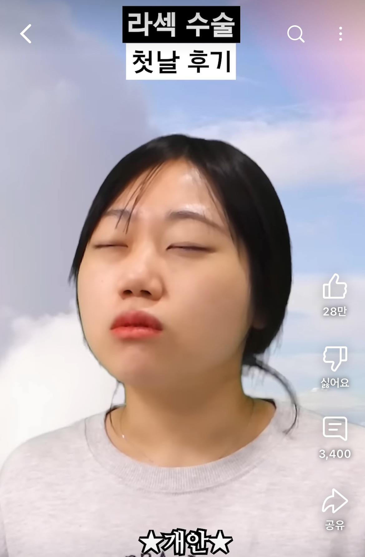 라섹-수술-후기-공감-100000%인-영상-26-이미지