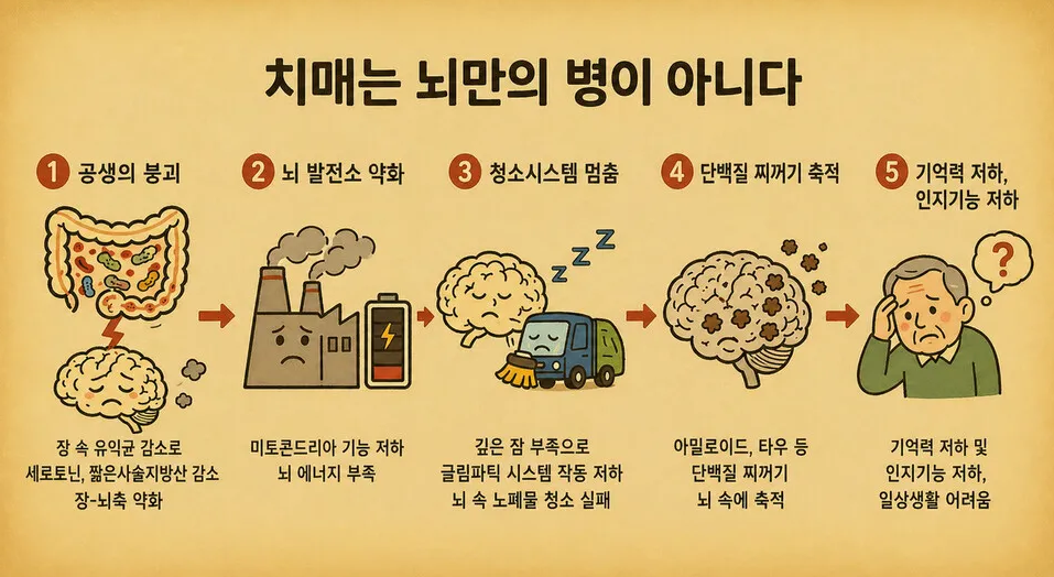 치매는-뇌만의-병이-아니다…장이-약하면-더-빨리-찾아와-0-이미지