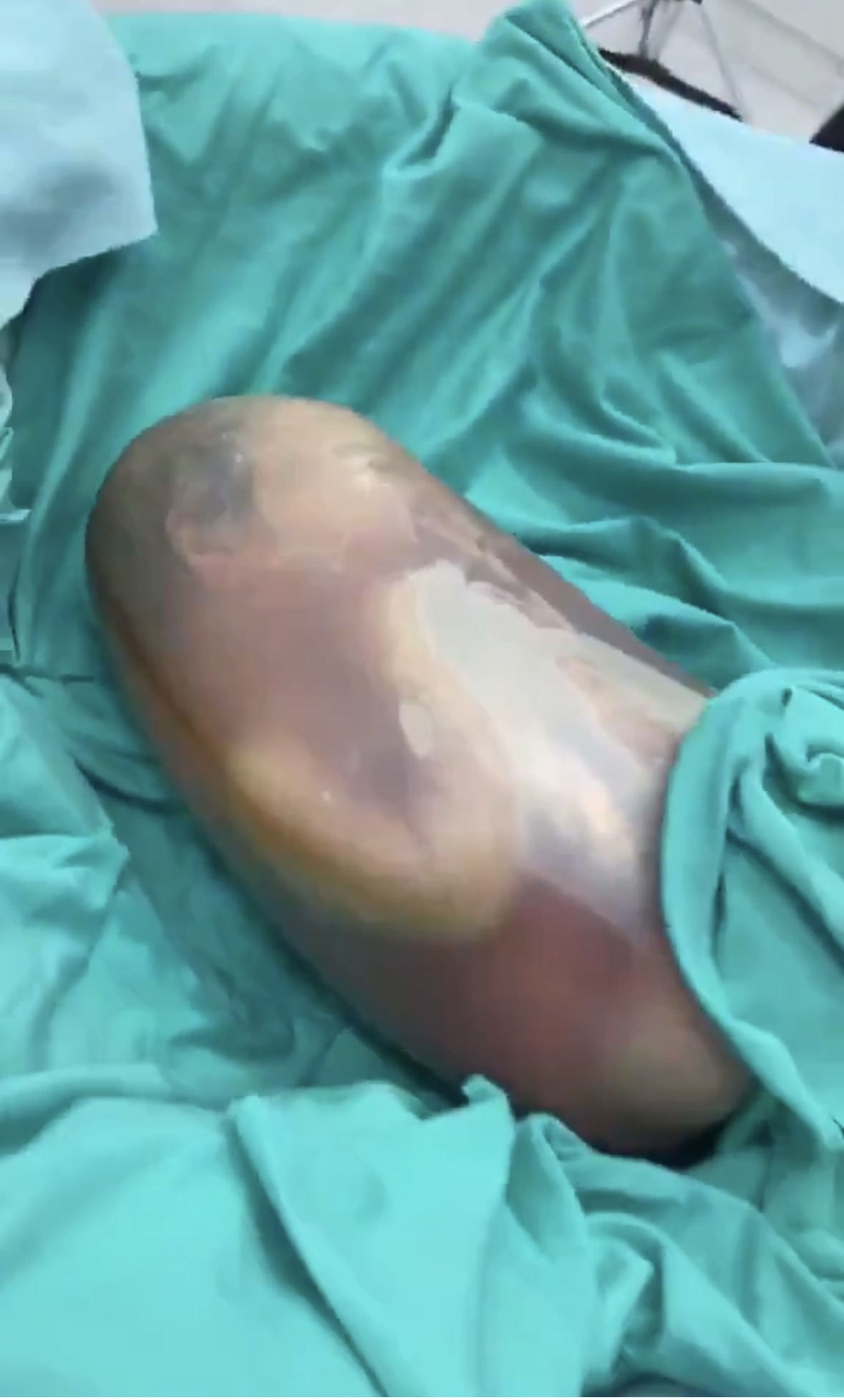 태어났다는-사실을-모른-채-세상에-온-아기.twt-1-이미지