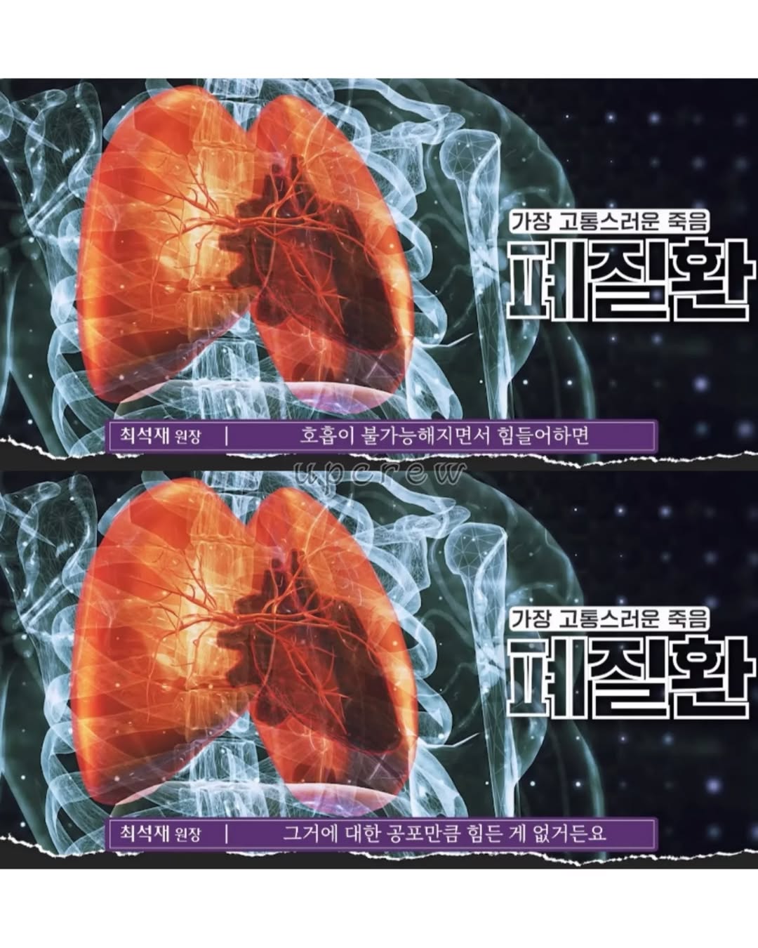 사람이-겪을-수-있는-가장-고통스러운-죽음-4-이미지