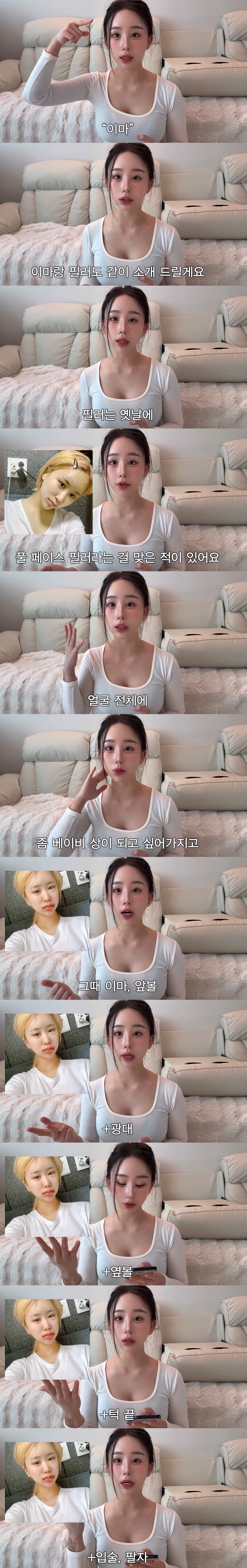 중2때부터-성형-한-사람의-성형-총-정리-5-이미지