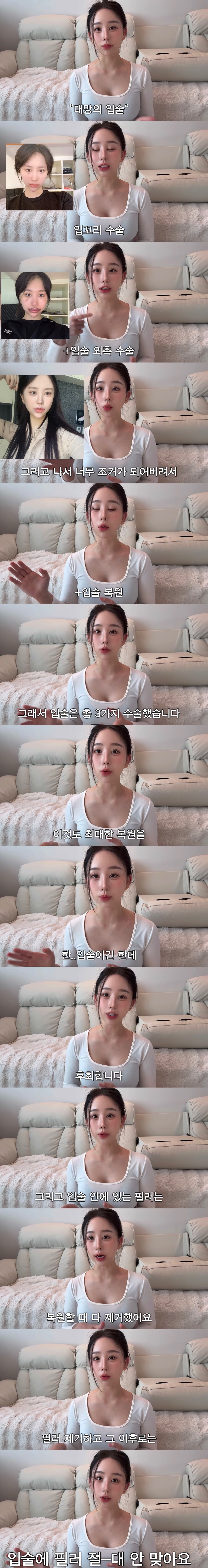 중2때부터-성형-한-사람의-성형-총-정리-3-이미지