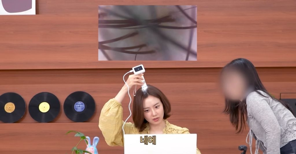 머리-냄새,-입냄새-루머-해명하는-문채원-0-이미지
