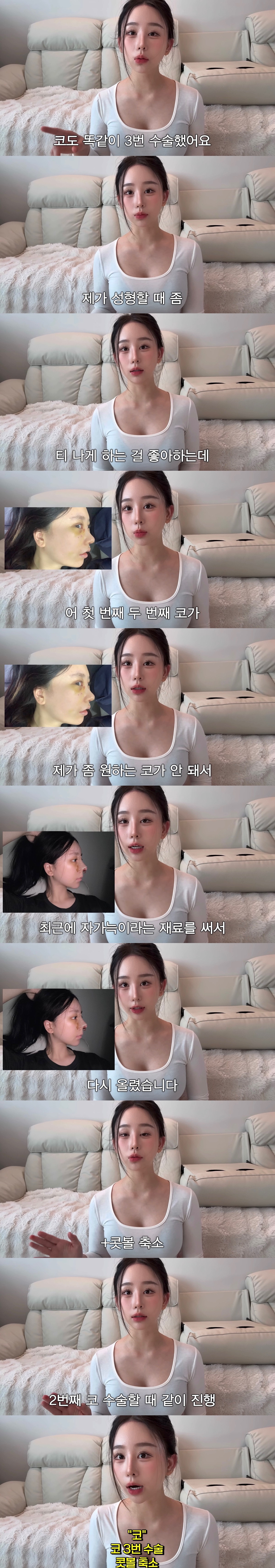 중2때부터-성형-한-사람의-성형-총-정리-2-이미지
