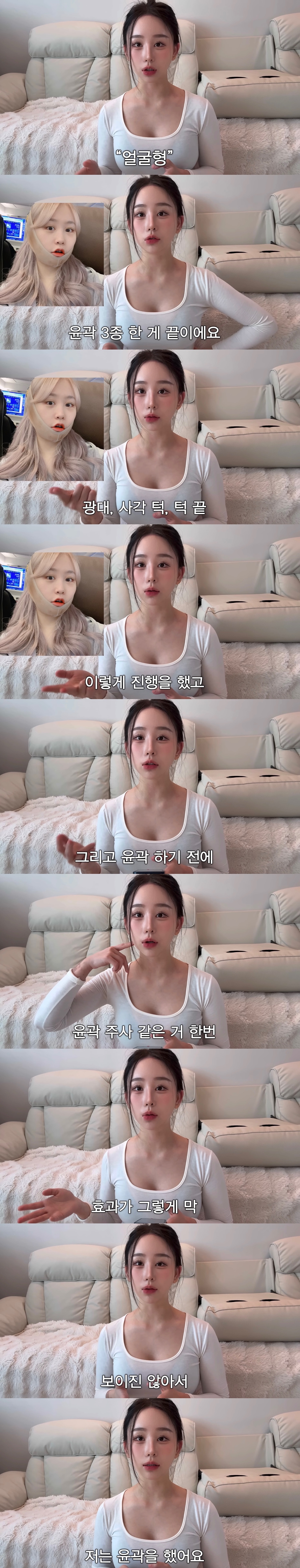 중2때부터-성형-한-사람의-성형-총-정리-4-이미지