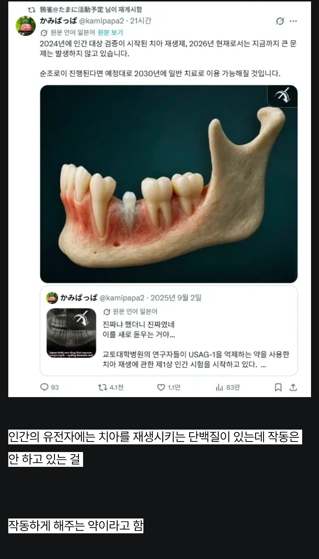 치아재생제-최근-근황-1-이미지