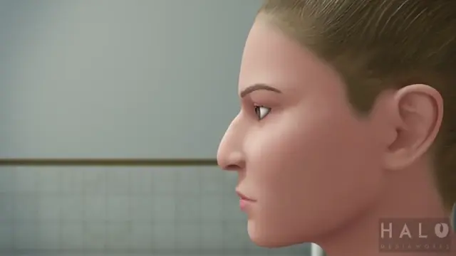 메부리코-성형수술-과정-0-이미지