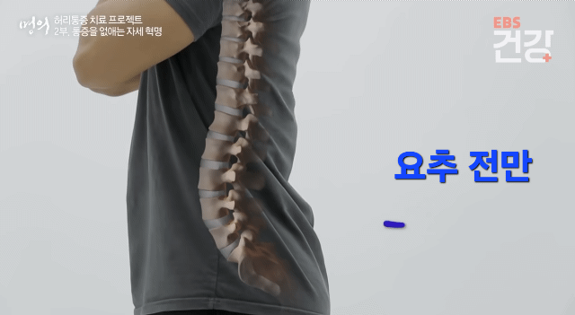 허리-디스크-:-통증의-간단한-이해-5-이미지