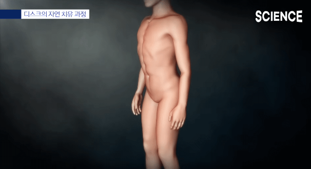 허리-디스크-:-통증의-간단한-이해-3-이미지