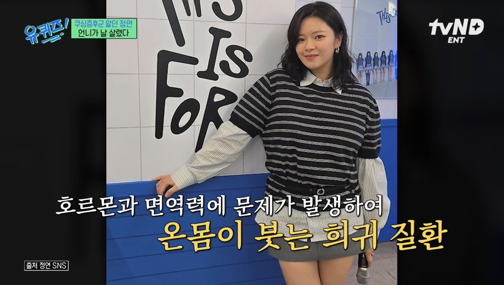 희귀병을-앓던-정연의-건강을-되찾아준-공승연-10-이미지