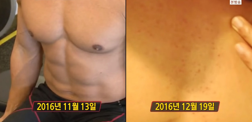 저탄수화물-고지방-(저탄고지)-다이어트의-부작용..jpg-14-이미지