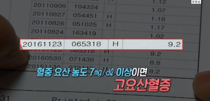 저탄수화물-고지방-(저탄고지)-다이어트의-부작용..jpg-18-이미지