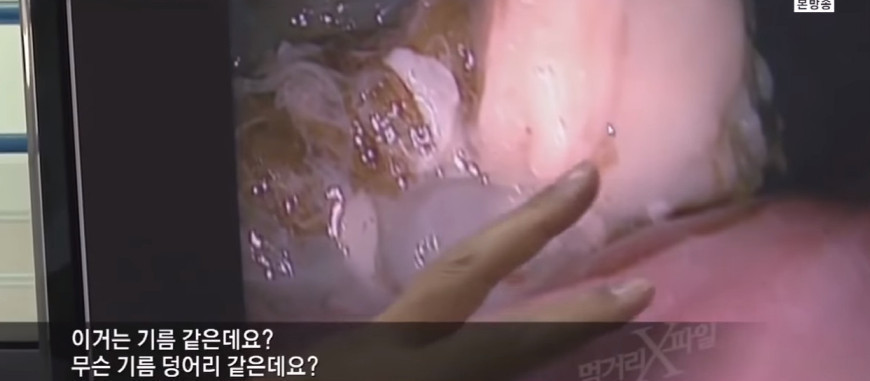 저탄수화물-고지방-(저탄고지)-다이어트의-부작용..jpg-30-이미지