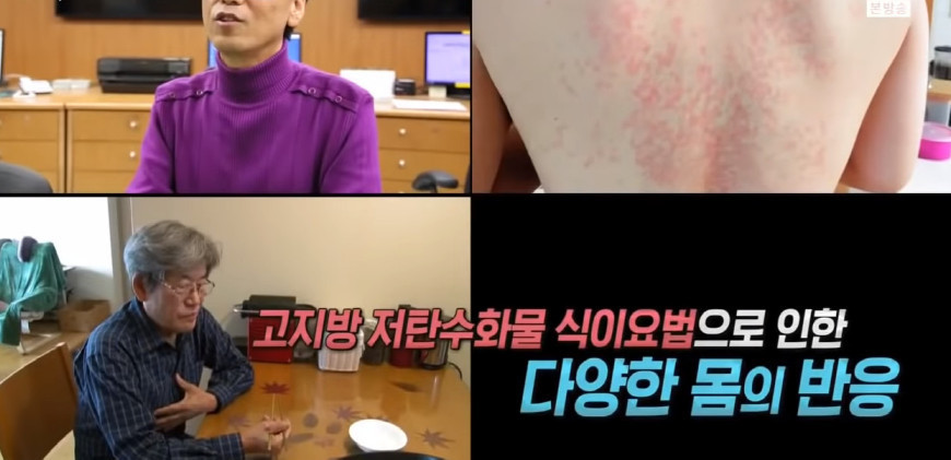 저탄수화물-고지방-(저탄고지)-다이어트의-부작용..jpg-20-이미지