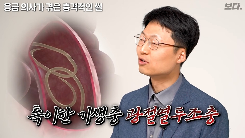 몸을-배배-꼬며-응급실에-온-환자-엉덩이에서-나온-것-39-이미지