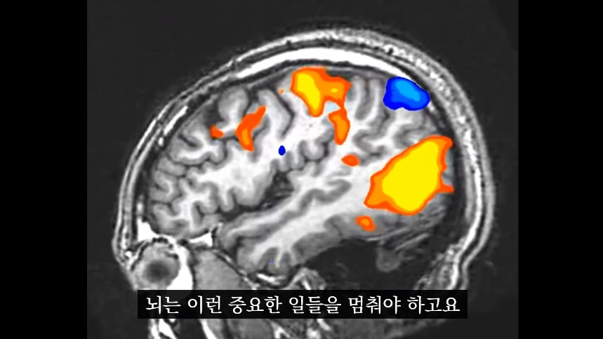 집안-곰팡이가-치매-유발한다는거-알았어?-29-이미지