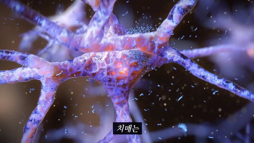 집안-곰팡이가-치매-유발한다는거-알았어?-2-이미지