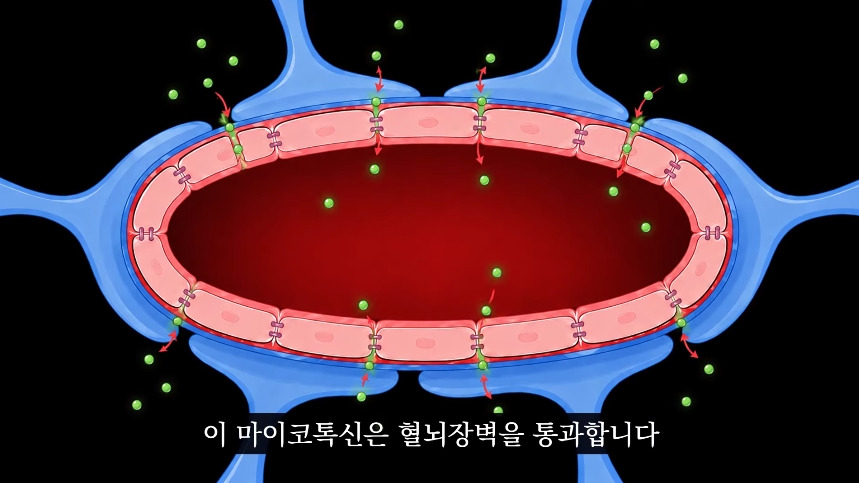 집안-곰팡이가-치매-유발한다는거-알았어?-46-이미지